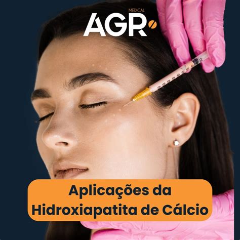  Osseointegration Marvel: Desvendando as Aplicações Industriais da Osteointegração com Hidroxiapatita!